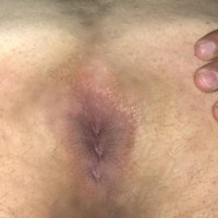 es
