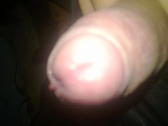 aaaaaaaaa - Photo #1776