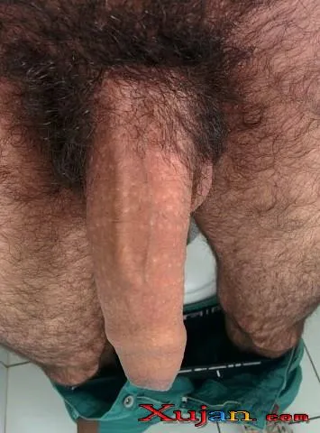 ova uzum ??? - Photo #5398