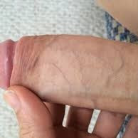 im