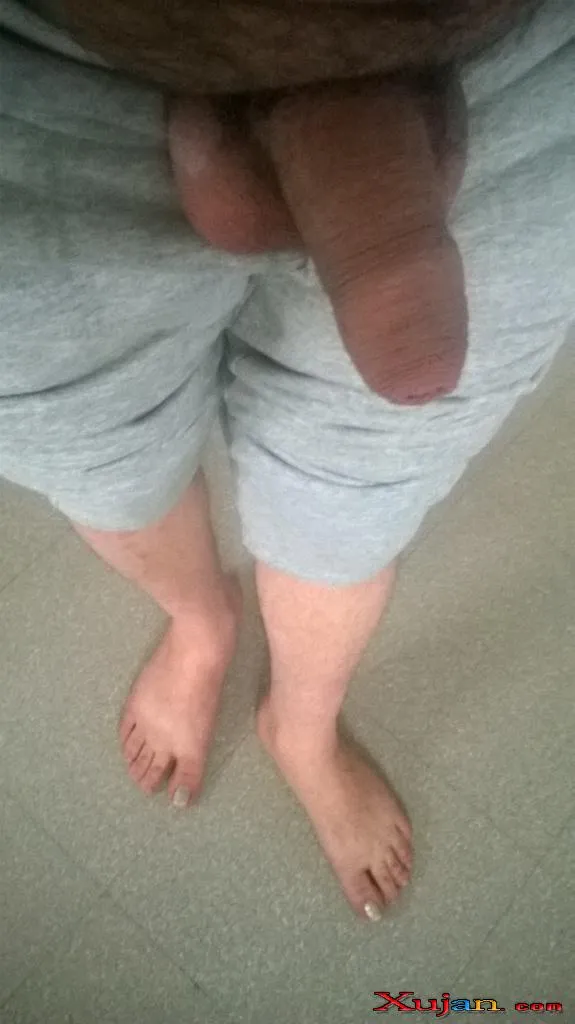 Feet Hairy - Photo #2920
