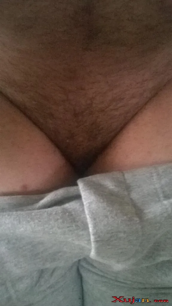 Feet Hairy - Photo #2925