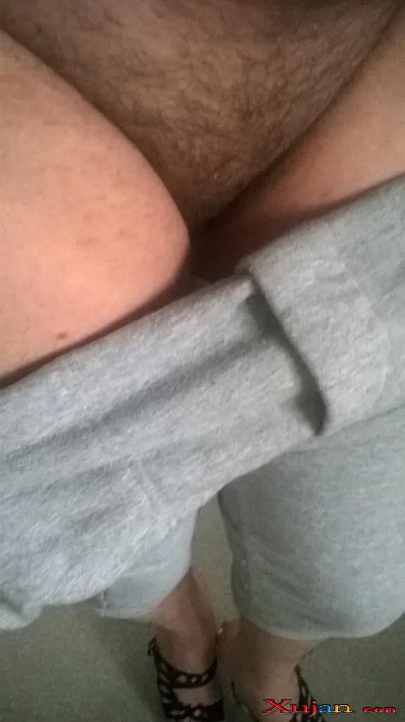 Feet Hairy - Photo #2926