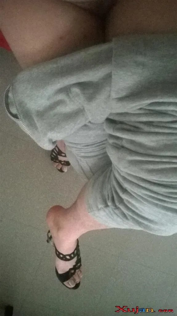 Feet Hairy - Photo #2928