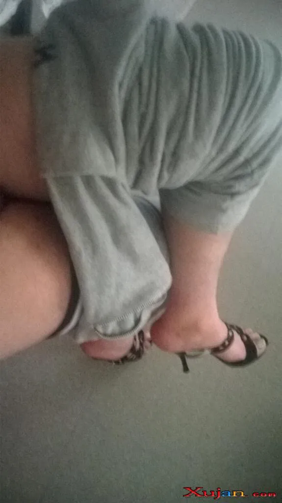 Feet Hairy - Photo #2929