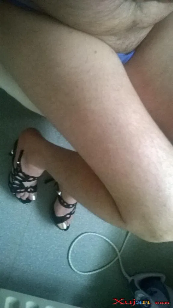 Feet Hairy - Photo #2938