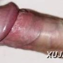 Klirs