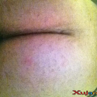 imnaa