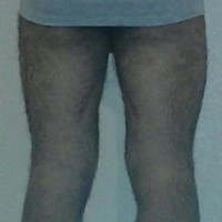 es