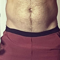 Es