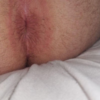 Asses and assholes