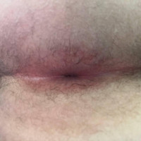 Es