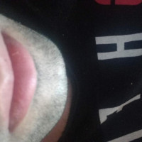 IM