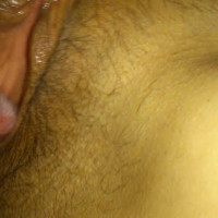 Knojs koxeq