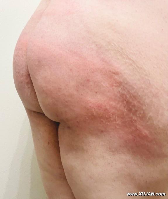 Post spanking with plug - Photo #241109
