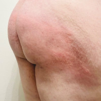 Post spanking with plug