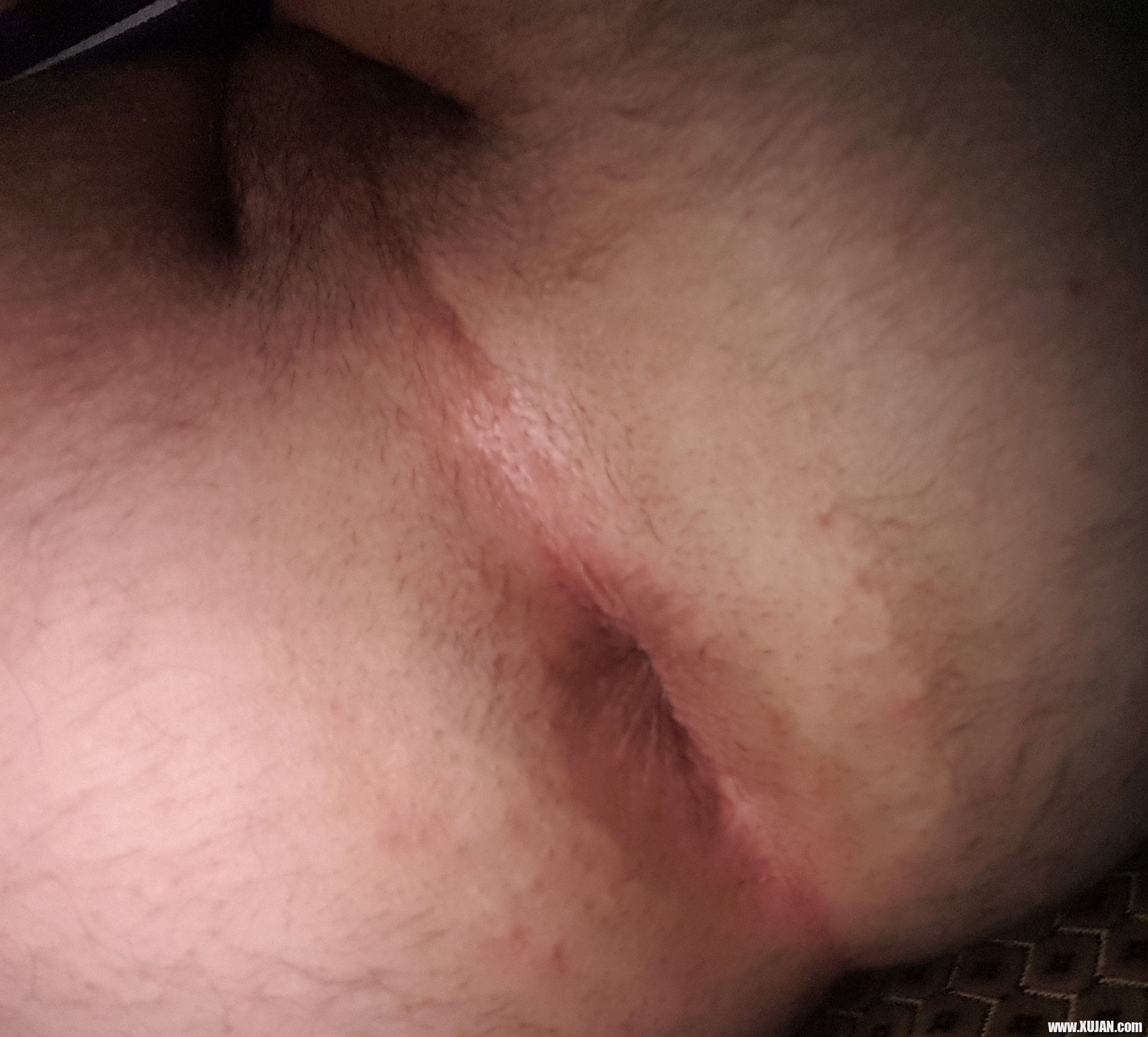 Koxeq mejs - Photo #373611