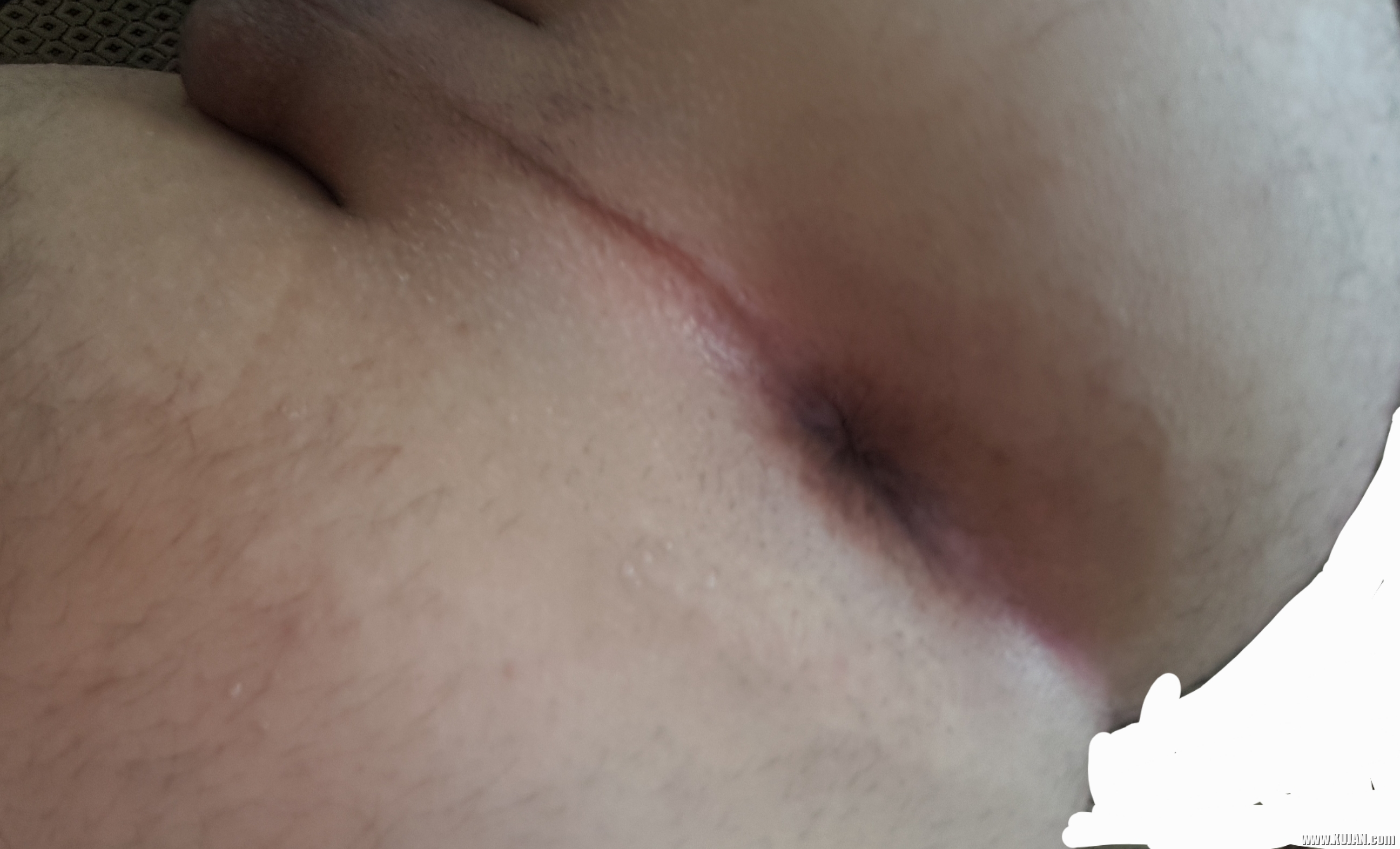 Ckass - Photo #559542