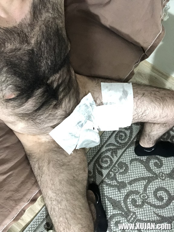 Very hairy man - Photo #565168
