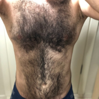 Very hairy man