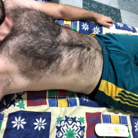 Very hairy man