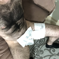 Very hairy man