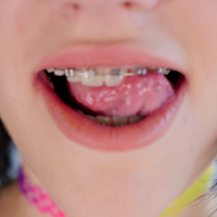 Kinky Karly Baker in braces gets down and dirty