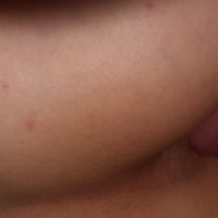 hetuyq anal babakhel