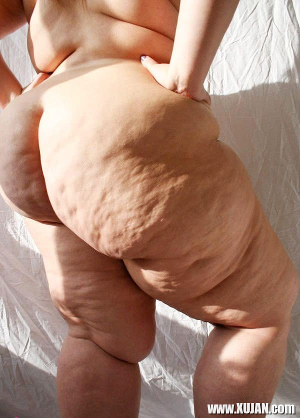 Chagh aghjik mets tselyuliti hetuyqov - Photo #2007561