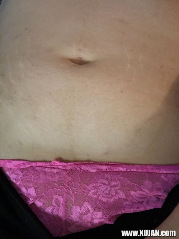 Meeee - Photo #2189765
