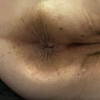 Mets hetuyq Bbw seqsual nerqnazgest