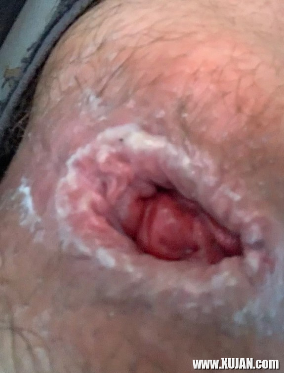 Petrvari 6 i Anal Gape nkarner - Photo #2263805