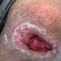 Petrvari 6 i Anal Gape nkarner