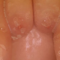 Tit Shots