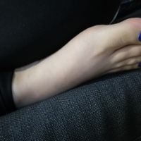 Kataryal votqer ev nerbanner