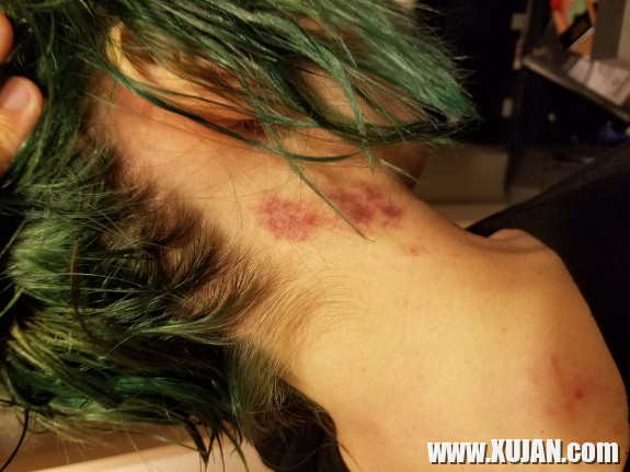 Aquas Lusankarner - Photo #2411377