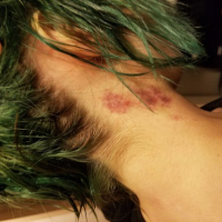 Aquas Lusankarner