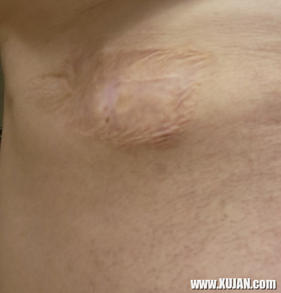 Parzapes aveli zvarchatseq knoj het - Photo #2510727