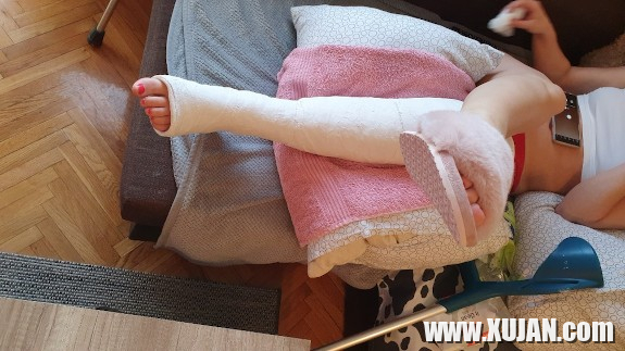 Erkar votqi gips - Photo #2519944