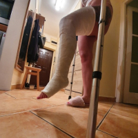 Erkar votqi gips