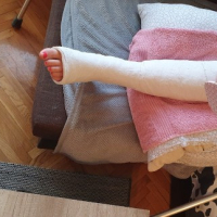 Erkar votqi gips
