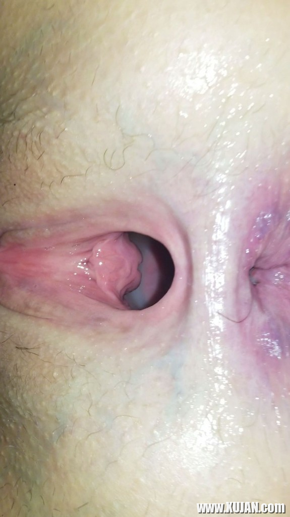 Wifes creampied pucy antsq - Photo #2549252