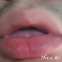 Es