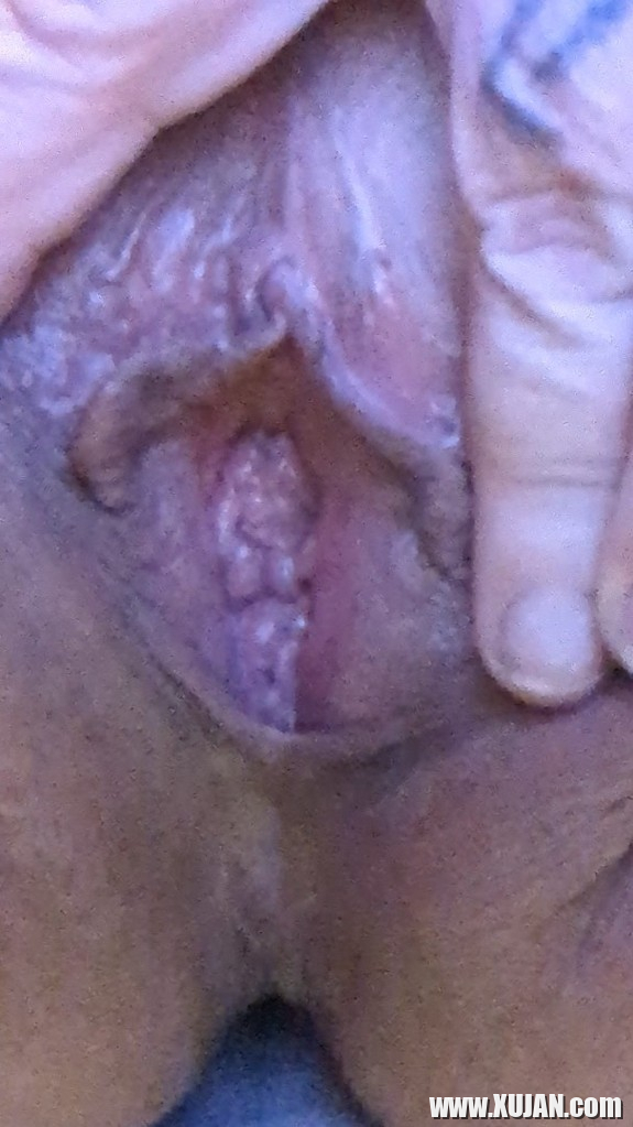 Bavakanin kit - Photo #2603644