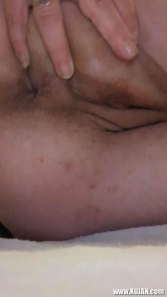 Bavakanin kit - Photo #2603656