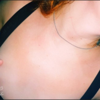 Redhead kiny taq lusankarner