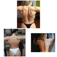 Miasss