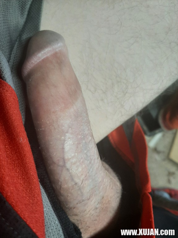 NewtoBlock - Photo #2921973