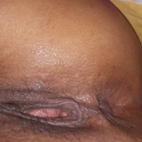 1 in 20 pornhub i lusankarner shat avelin orpeszi kutakven