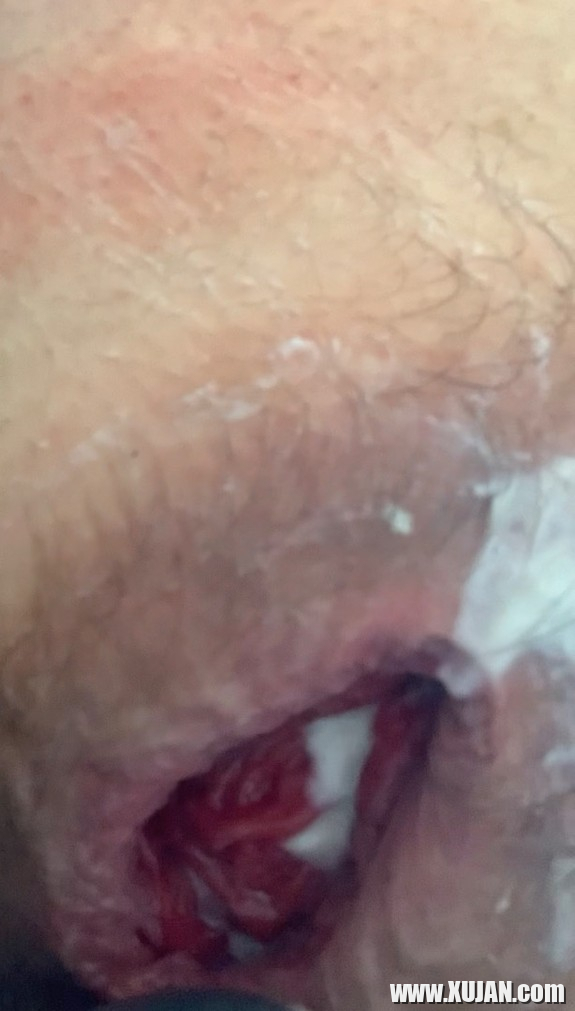 Petruari 6 rd anal batsi lusankarner - Photo #3067940